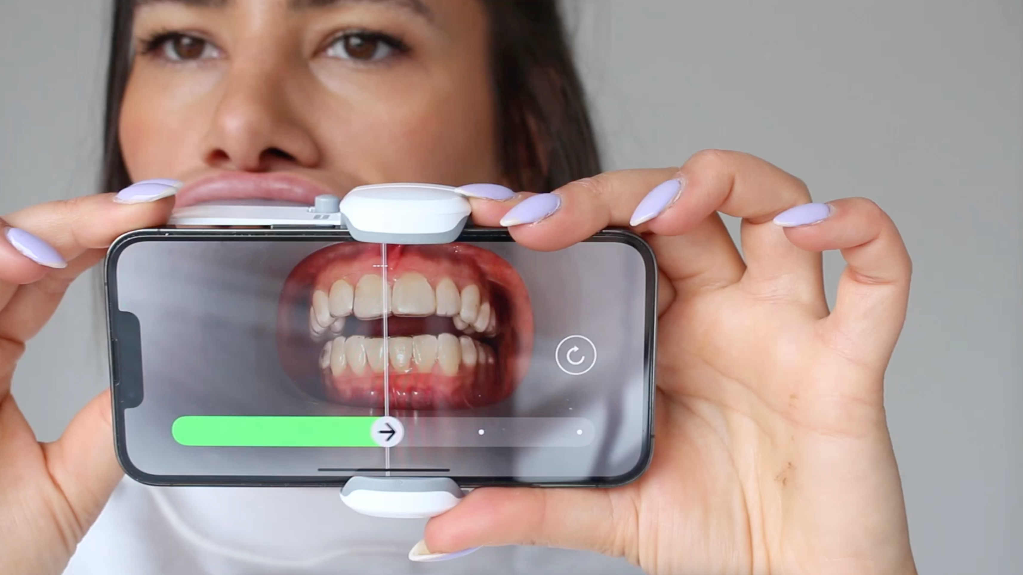 Load video: Bitesoft Co Scanbox