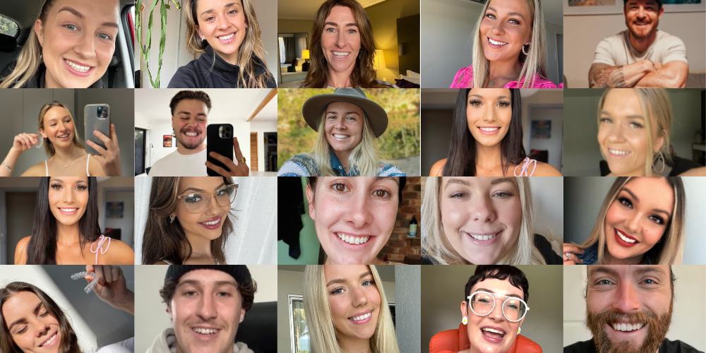 Bitesoft Co Clear Aligners